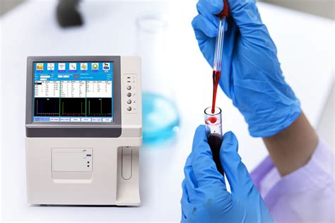 gas analyzer working principle|Blood Gas Analyzers: Overview, Functions, Types, And Uses.